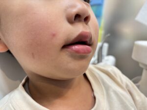 お口がぽかんとひらいている状態